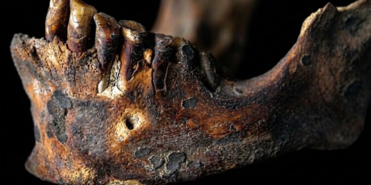 Estudio de odontología forense de los restos humanos procedentes de los sitios arqueológicos cueva funeraria de Daniel y abrigo de Daniel, Samaná, República Dominicana